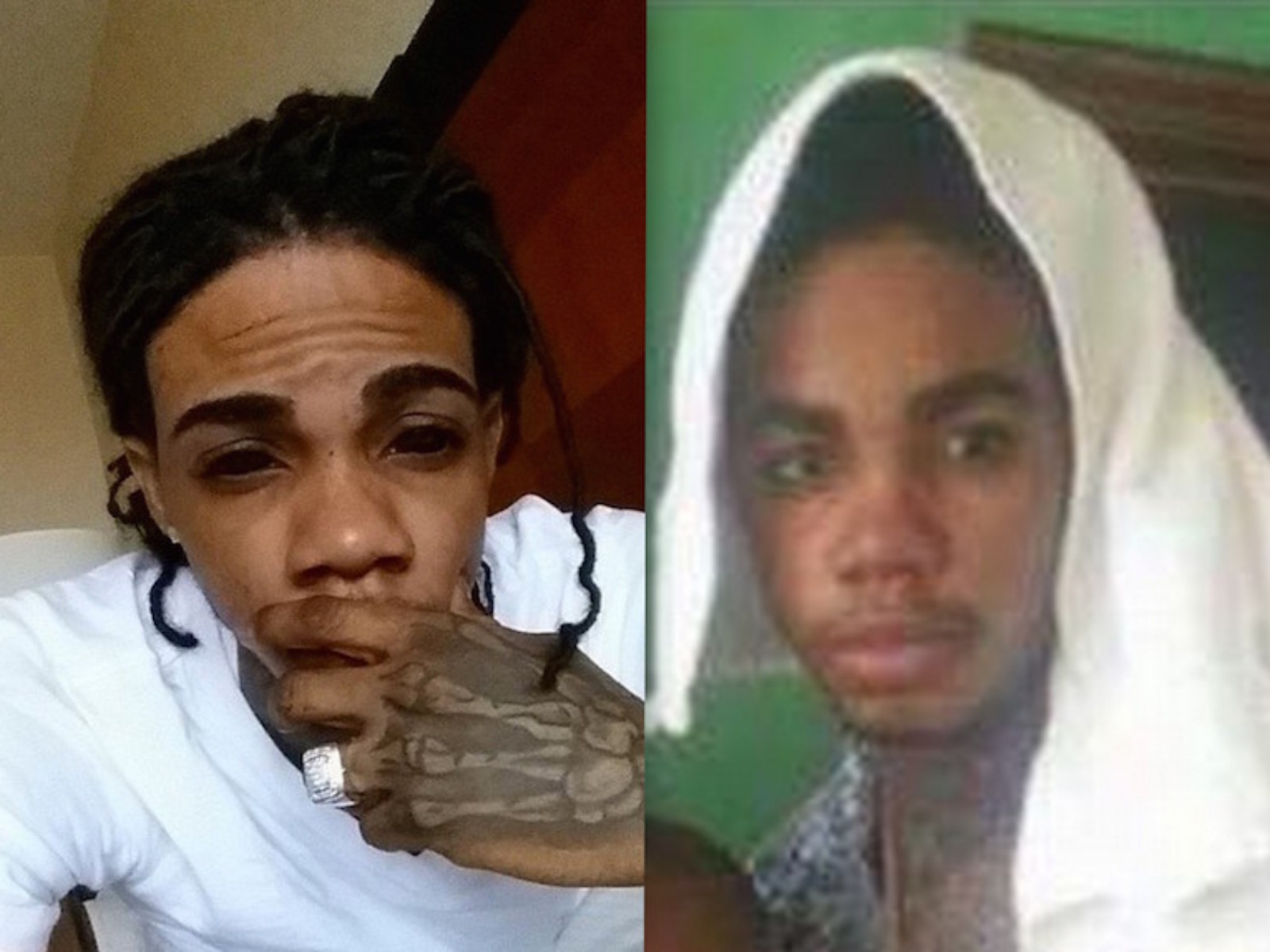 Did Alkaline Removed Eyeball Tattoo Or Was It Contacts ? – www.IrieDale.com