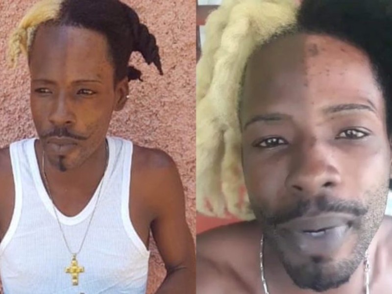 Dancehall Artiste SKP Bleached Half His Face Sparks Outraged