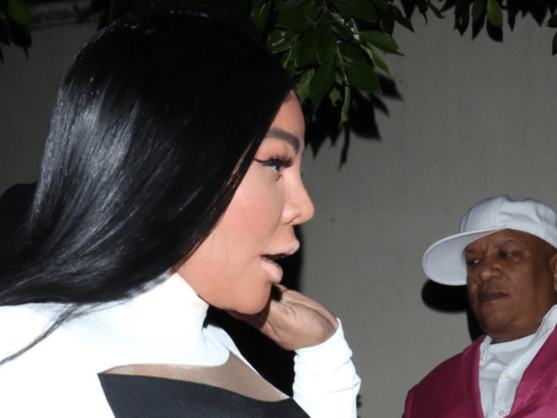 Rapper Lil Kim Reportedly Had MORE Surgery On Her Face & Body (Pics)