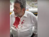 St. Vincent’s Prime Minister Hospitalized after Getting Hit in The Head With A STONE